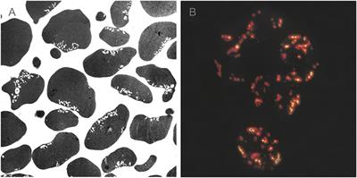 Budding and Fission of Membrane Vesicles: A Mini Review